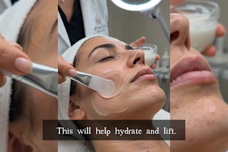 edit instagram reels for medical spa esthetic clinics