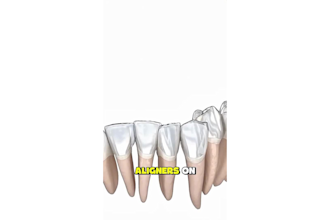 create realistic 3d medical and dental animation explainer video
