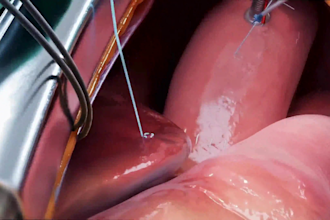 create 4k 3d medical animation for surgery procedure or product demo HD