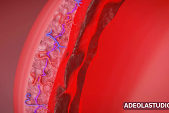 create best 3d medical explainer animation video for 3d sepsis retained placenta