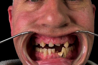 design medical or dental animation videos in after effects