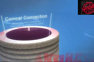 create 3d medical animation dental implant procedure videos orthodontic ads
