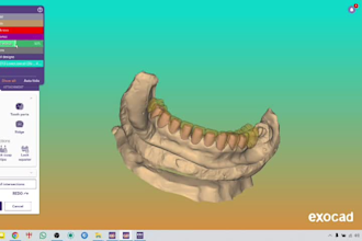 design dental crowns and bridges in exocad