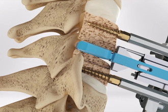 create 3d medical animation, medical device and surgical product animation