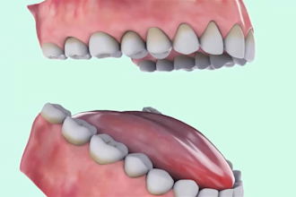 create 3d medical animation for dental anatomy, surgery, and scientific explaine