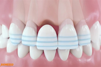 create cinematic 3d medical, dental and surgical explainer animation