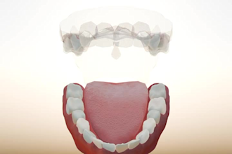 create 3d dental surgery, orthodontic implant, tooth explainer medical animation