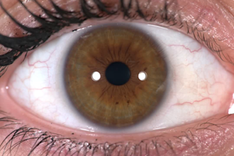 edit your eye photo and the result will amaze you