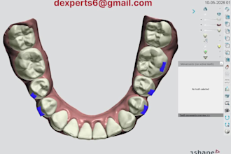 do dental clear aligner treatment planning on 3shape