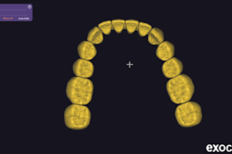 designe a professional full denture on exocad with high quality
