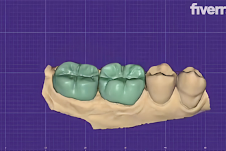 design professional dental crowns, bridges