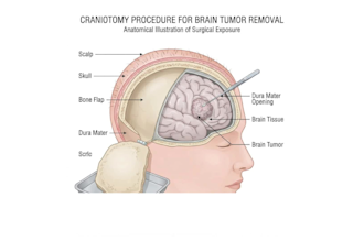 custom anatomy diagrams, medical illustrations and educational graphics