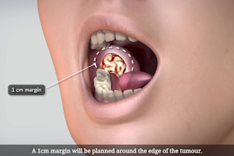 create 3d medical video surgical animation anatomy animation dental procedure