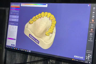 design zirconia bridge and crowns using exocad