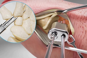 create 3d medical animation, healthcare explainer and scientific animation