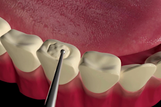 create 3d dental animation, medical animation, 3d dental explainer video