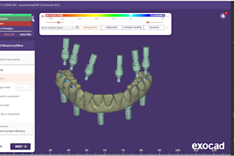 do professional all on x and full arch dental cases on exocad