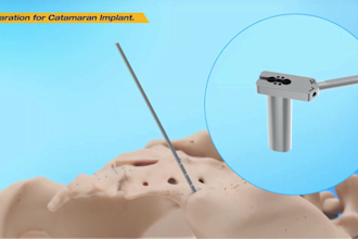 create 3d medical device and surgical implant animation