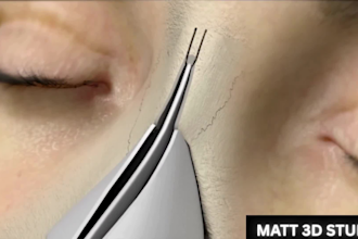 create 3d medical rhinoplasty animation, surgery animation, surgical animation