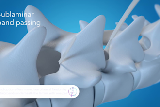 do 3d medical animation 3d surgical explainer video 3d medical device bio tech