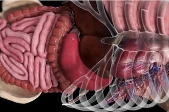 create 3d medical animation surgery anatomical 3d medical device explainer video