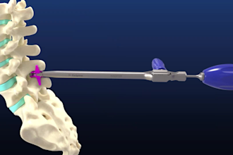 3d medical product animation, prosthetic device design, orthotic equipment model