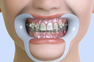 3d medical animation, surgery video, dental care animation, 3d medical device