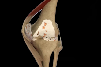 create 3d medical animation, 3d train,  patient education, medical animation