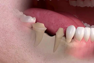 provide custom 3d medical animation video, 3d dental video, 3d human anatomy