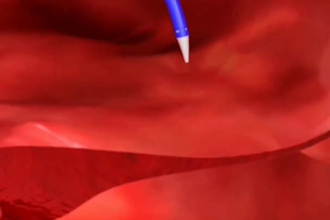do 3d medical animation video anatomy, dental animation for 3d product animation