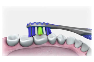 3d dental brush animation 3d medical animation 3d healthcare 3d tooth implant