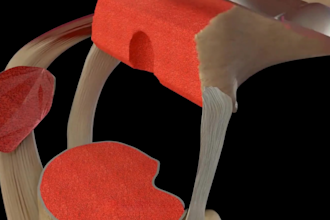 3d medical animation, medical explanation video for 3d surgery, dental animation