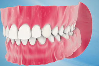 create 3d teeth animation, dental explainer, and orthodontic treatment video
