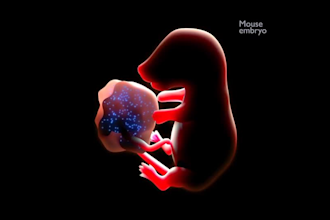 do disease awareness video, medical animation video, anaesthetic brain surgery
