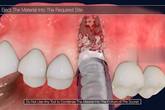 create realistic 3d medical animation for dental procedure teeth explainer video