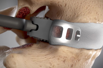 do 3d medical animation