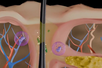 create explainer medical animation video surgery animation medical presentation
