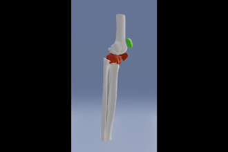 make medical animation short video