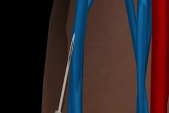 do professional 3d medical animation, 3d surgery, medicine rending, 3d animation