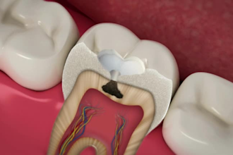 do 3d biomedical dental animation, medical animation and surgery explainer