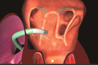 do realistic 2d 3d medical anatomy animation video industrial surgery animation