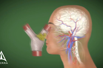 create realistic 3d medical animations for surgery and anatomy