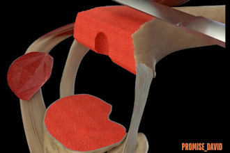 create 3d medical animation for clinics, cancer surgery, 3d product animation