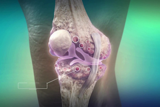 3d medical device explainer, anatomy video and medical animation