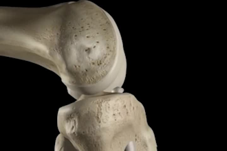do 3d animation,medical animation,medical 3d medical animation surgery animation
