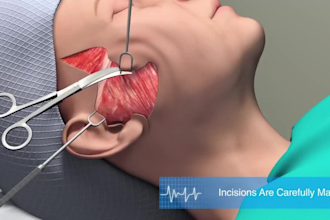 do 3d medical animation 3d biomedical dental animation surgery explainer