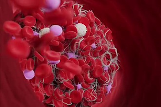 create 3d medical animation, medical explainer video, surgery animation, medical