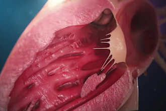 create 3dmedical animation video surgery human anatomy explainer education video
