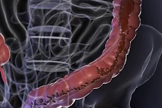 3d medical animation,medical training video,medical explainer videoe,3d anatomy