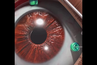 do 4k 3d medical animation, medical product animation, surgery anatomy animation